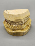 Plaster Dental Typodont Teeth Model Jaw Cast Upper Lower Yellow Teaching Study