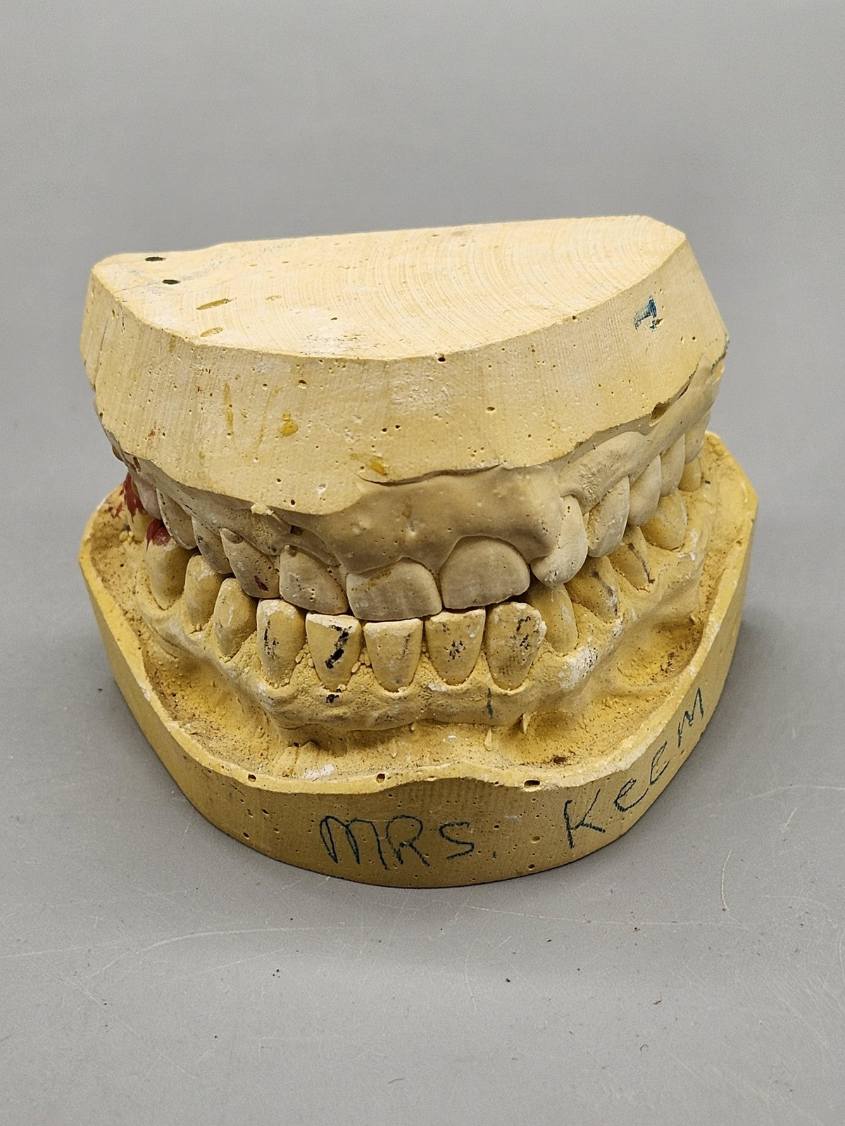 Plaster Dental Typodont Teeth Model Jaw Cast Upper Lower Yellow Teaching Study