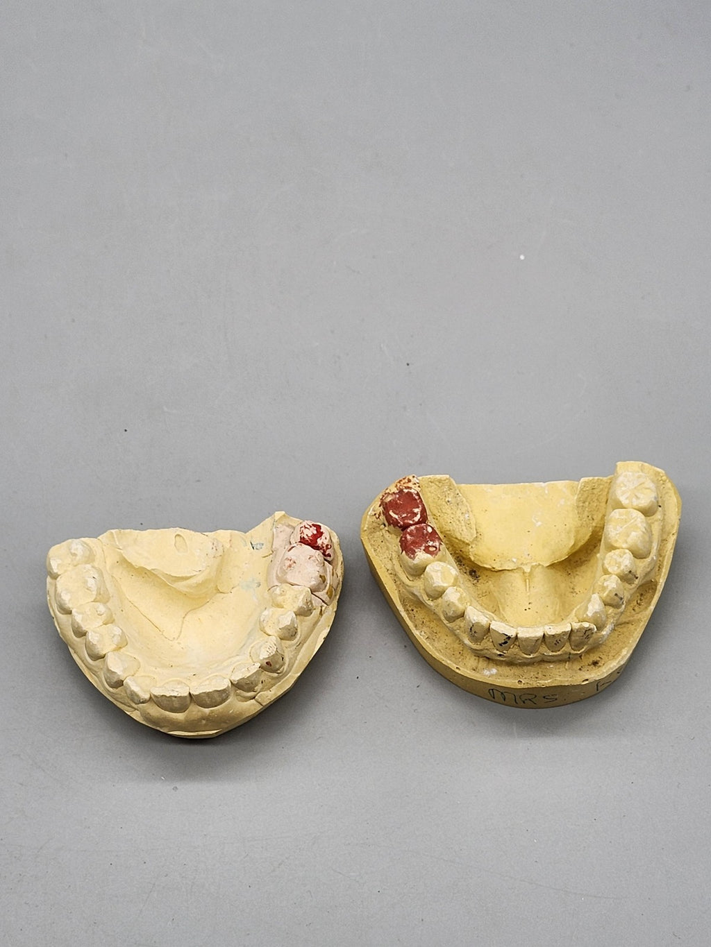Plaster Dental Typodont Teeth Model Jaw Cast Upper Lower Yellow Teaching Study