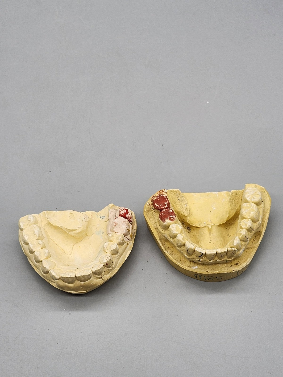 Plaster Dental Typodont Teeth Model Jaw Cast Upper Lower Yellow Teaching Study