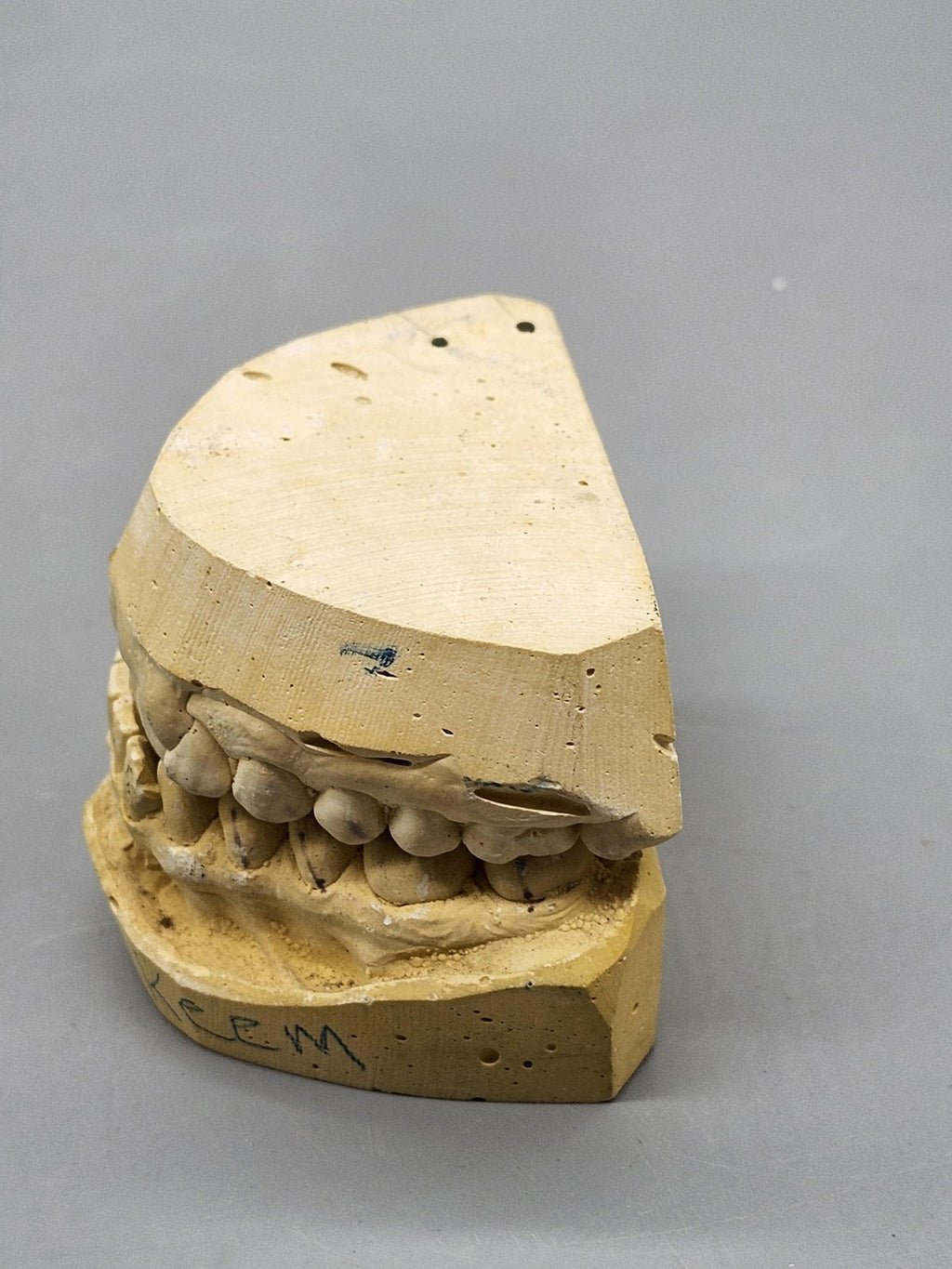 Plaster Dental Typodont Teeth Model Jaw Cast Upper Lower Yellow Teaching Study